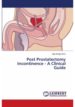 Post Prostatectomy Incontinence - A Clinical Guide