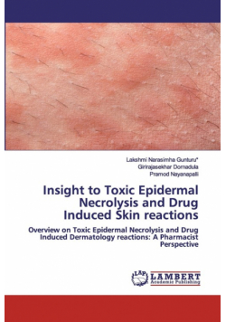 Insight to Toxic Epidermal Necrolysis and Drug Induced Skin reactions