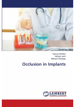 Occlusion in Implants