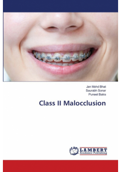 Class II Malocclusion