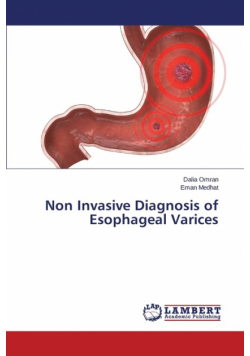 Non Invasive Diagnosis of Esophageal Varices