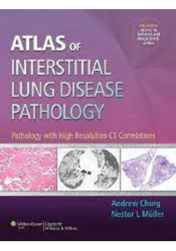 Systemic Vasculitides