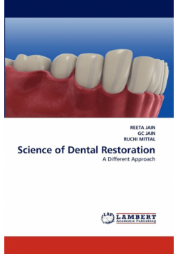 Science of Dental Restoration