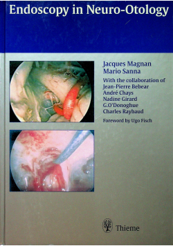 Endoscopy in Neuro Otology