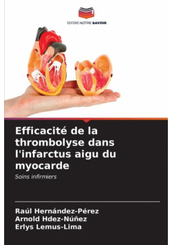 Efficacité de la thrombolyse dans l'infarctus aigu du myocarde
