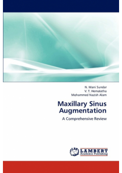 Maxillary Sinus Augmentation