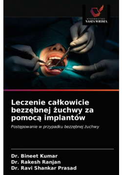 Leczenie całkowicie bezzębnej żuchwy za pomocą implantów
