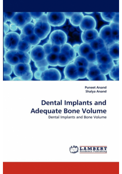Dental Implants and Adequate Bone Volume