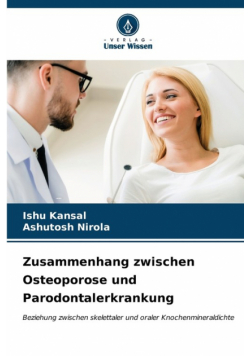 Zusammenhang zwischen Osteoporose und Parodontalerkrankung
