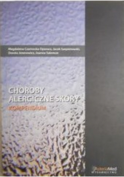 Choroby alergiczne skóry