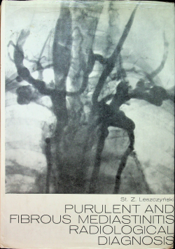 Purulent and Fibrous Mediastinitis radiological diagnosis