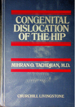 Congential dislocation of the hip