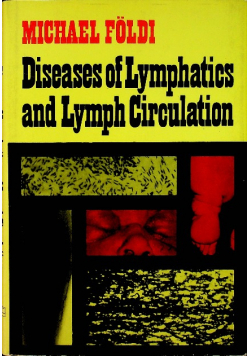 Diseases of lymphatics and lymph circulation