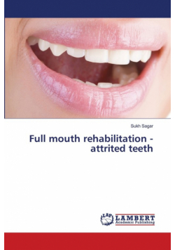Full mouth rehabilitation - attrited teeth