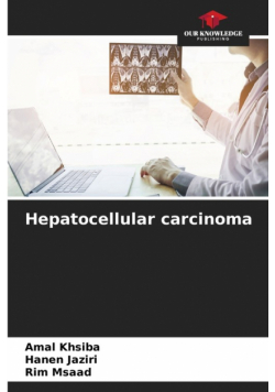 Hepatocellular carcinoma