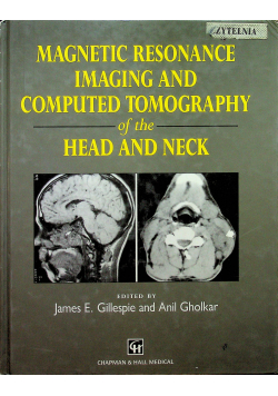 Magnetic Resonance imaging and computed tomography of the head and neck