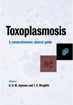 Toxoplasmosis