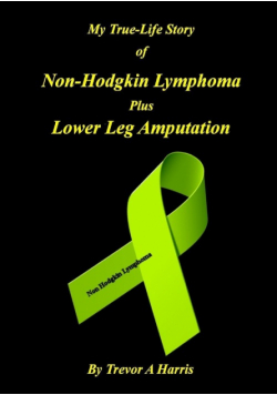 My True-Life Story of Non-Hodgkin Lymphoma plus Amputation