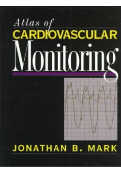 Atlas of cardiovascular Monitoring
