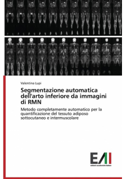 Segmentazione automatica dell'arto inferiore da immagini di RMN