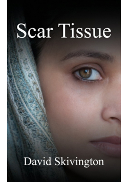 Scar Tissue
