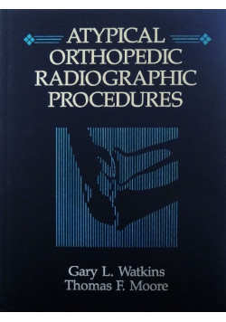 Atypical orthopedic radiographic procedures