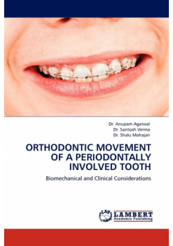 Orthodontic Movement Of A Periodontally Involved Tooth