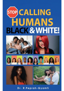 Stop Calling Humans Black And White