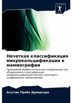 Нечеткая классификация микрокальцификации в маммографии