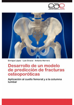 Desarrollo de un modelo de predicción de fracturas osteoporóticas