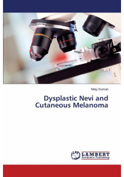 Dysplastic Nevi and Cutaneous Melanoma