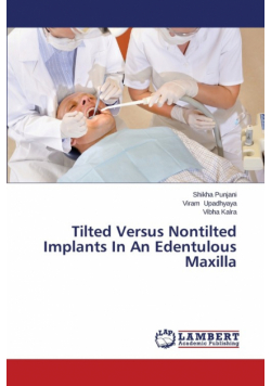 Tilted Versus Nontilted Implants In An Edentulous Maxilla