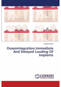 Osseointegration