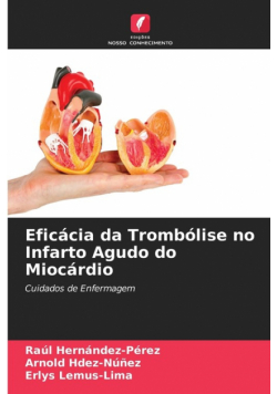 Eficácia da Trombólise no Infarto Agudo do Miocárdio