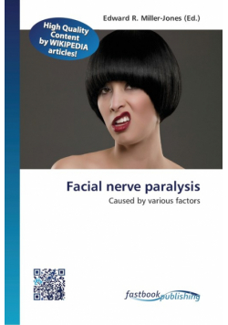 Facial nerve paralysis