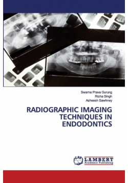 Radiographic Imaging Techniques In Endodontics