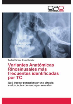 Variantes Anatómicas Rinosinusales más frecuentes identificadas por TC