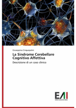 La Sindrome Cerebellare Cognitivo Affettiva