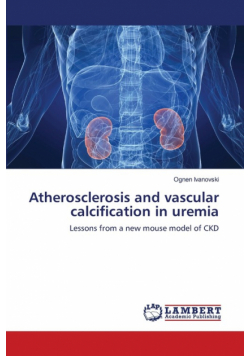 Atherosclerosis and vascular calcification in uremia