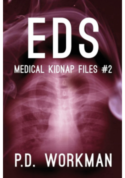 Eds