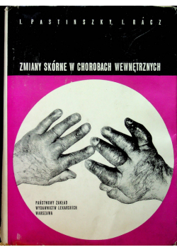 Zmiany skórne w chorobach wewnętrznych