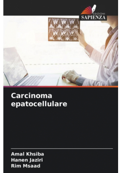 Carcinoma epatocellulare