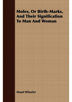 Moles, Or Birth-Marks, And Their Signification To Man And Woman