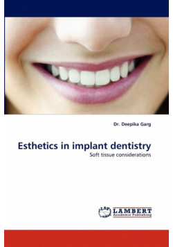 Esthetics in Implant Dentistry