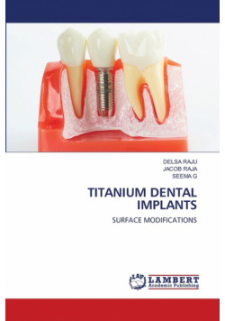 Titanium Dental Implants