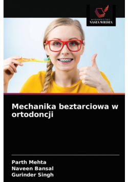 Mechanika beztarciowa w ortodoncji