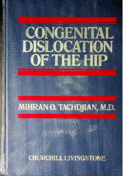 Congential dislocation of the hip
