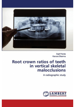 Root crown ratios of teeth in vertical skeletal malocclusions