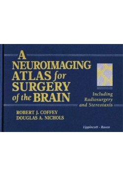 A Neuroimaging Atlas for Surgery of the Brain