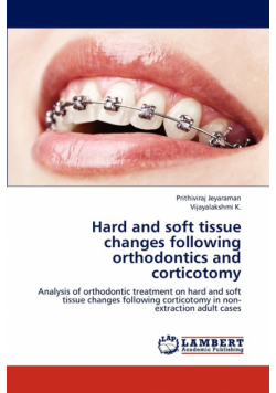 Hard and Soft Tissue Changes Following Orthodontics and Corticotomy